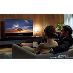 LG 75UM7110 SMART LED TV 75" (189cm) UHD
