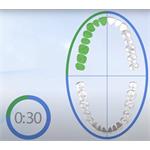 Philips HX6511/50 Sonicare EasyClean, elektrická sonická zubná kefka - rozbalené